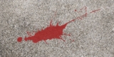 How to Clean Blood From Concrete Using Natural Products